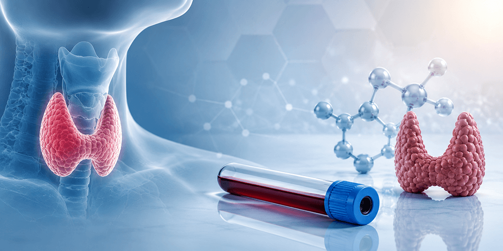 Hypothyroidism: A case-based approach in clinical practice